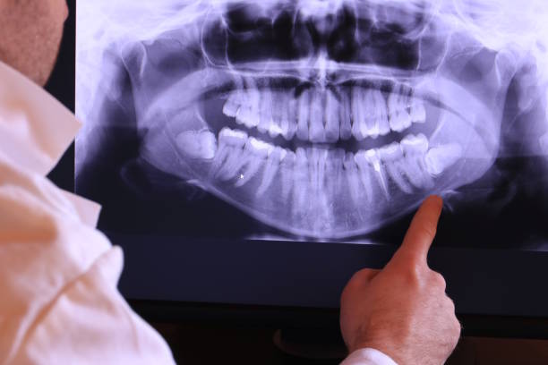 Best Emergency Treatment for Dental Infections or Abscesses in Good Hope, CA