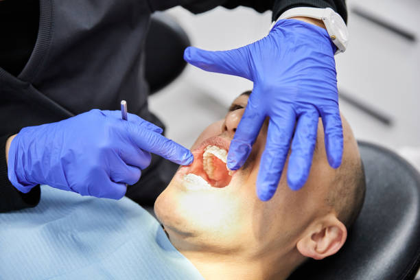 Best After-Hours Dental Trauma Care in Good Hope, CA